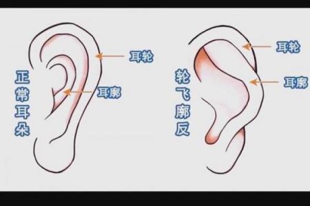 从面相看耳朵，耳朵面相算命图解