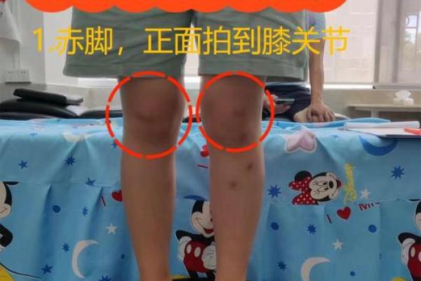 内八字、外八字孩子脚型正常不正常，家长可以这么判断