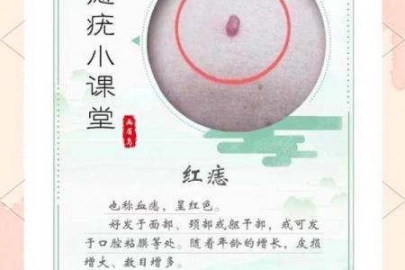 胎记算命图解：什么是红胎记？