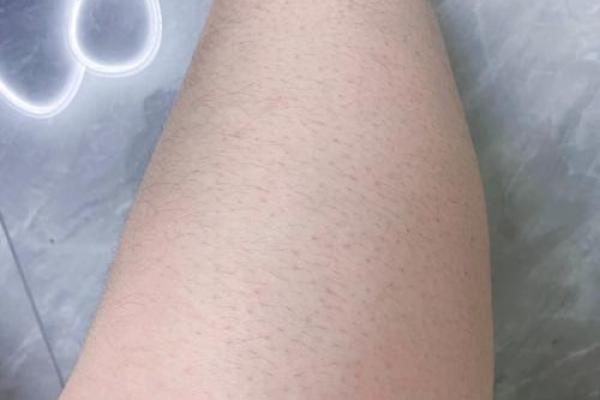 腿上有毛算命